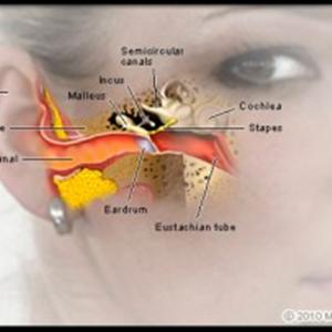 Objective Tinnitus Definition - Suffering From Tinnitus And Finding A Cure