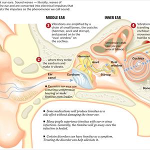 Bilateral Tinnitus Causes - Tinnitus Solution - Stop The Noises In Your Ears Before It Is Too Late